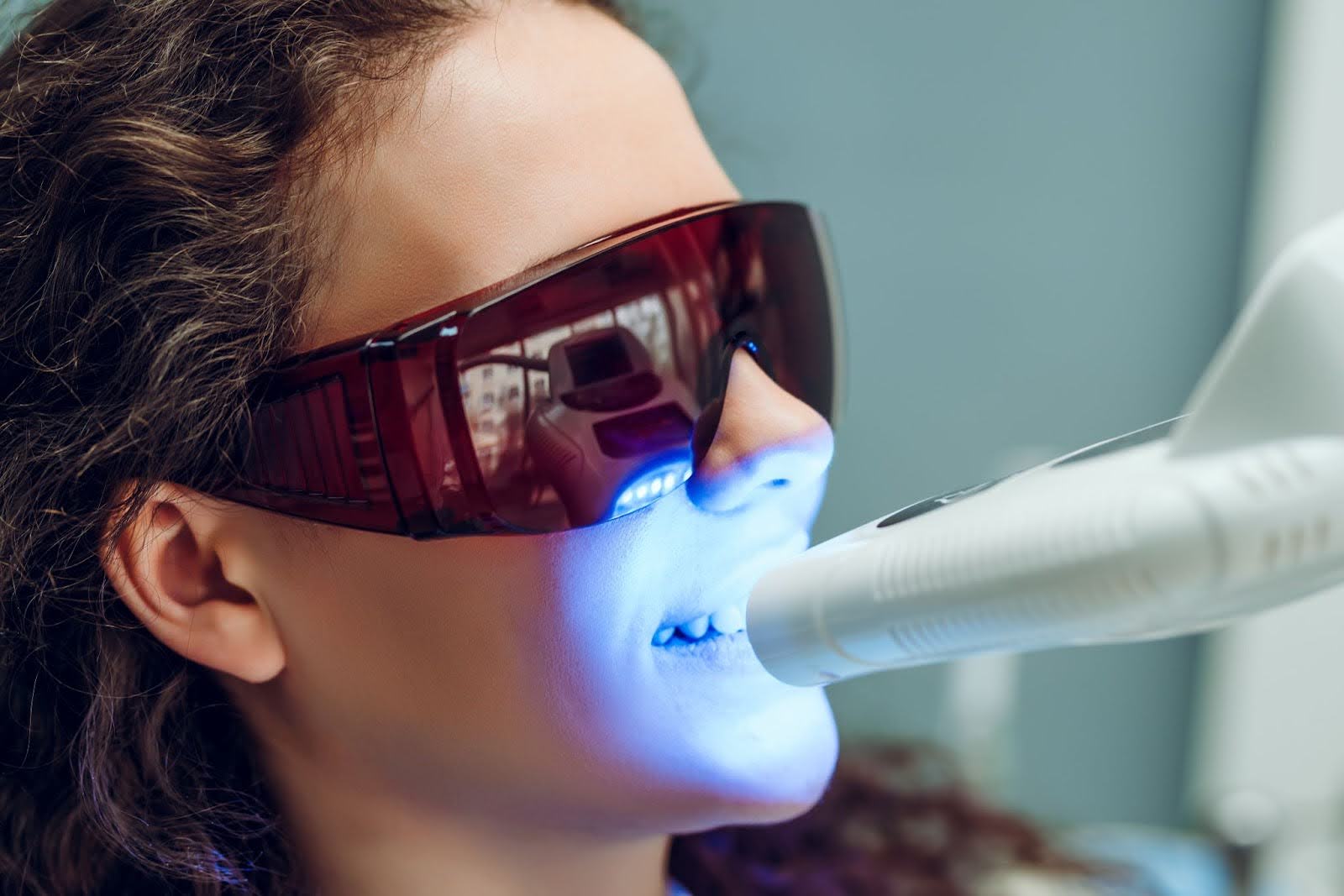 Choose Professional Teeth Whitening Services